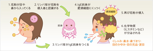 花粉症のメカニズム